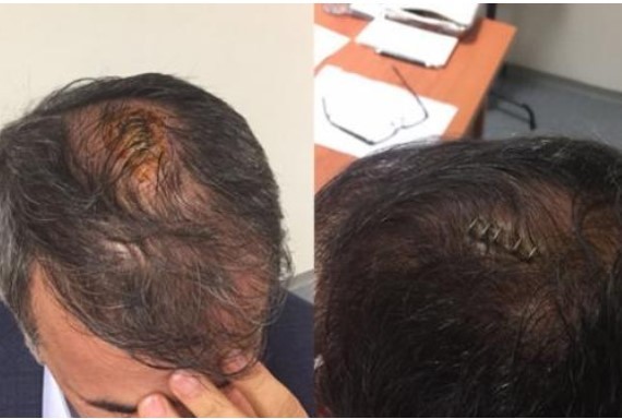 Aykut Kocaman'dan olay soru: Kan nerede?