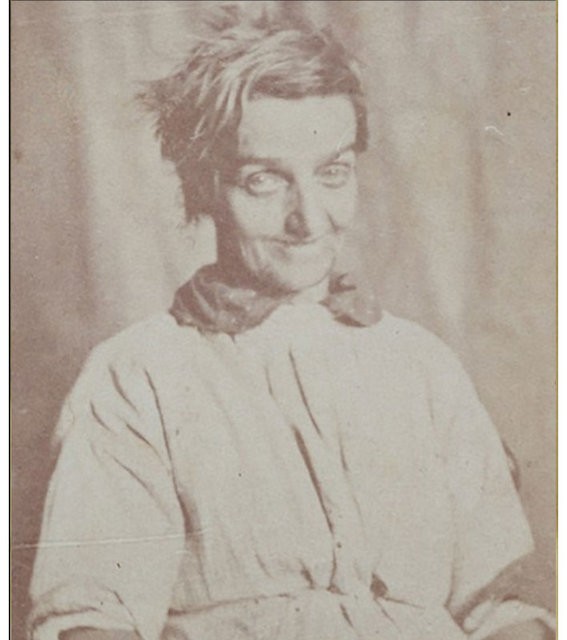 1800'lerin akıl hastanesinden tüyler ürperten fotoğraflar