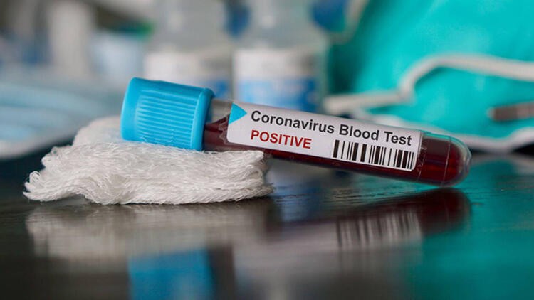 Korona virüs için 'sık sorulan sorular' kılavuzu hazırlandı