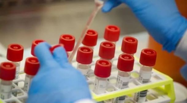Bilim insanları ilk kez bu kadar net görüntüledi: Virüs böyle öldürüyor