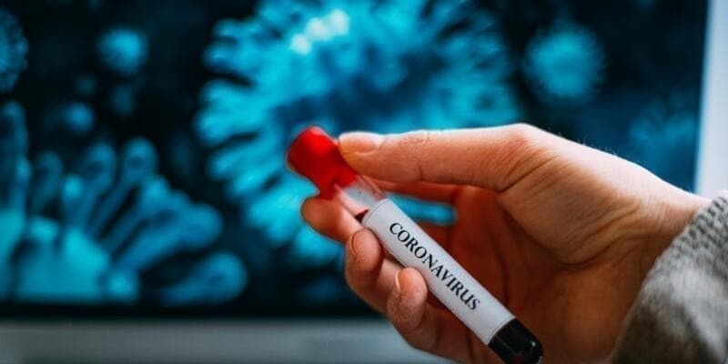 Sağlık Bakanlığı illere ve yaşa göre Kovid-19 verilerini paylaştı!