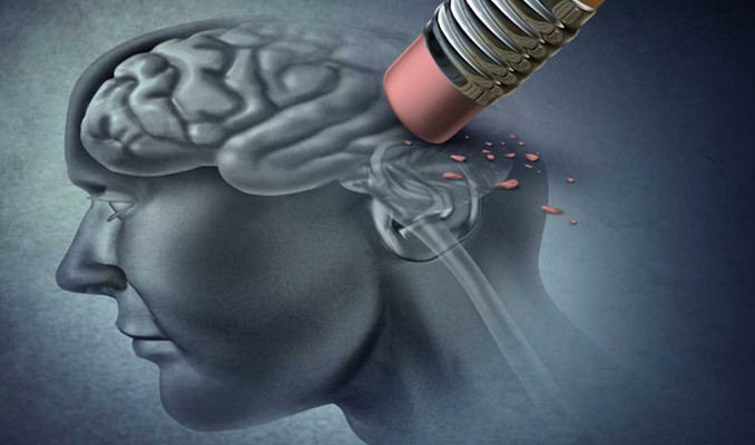 Alzheimer için korkutan uyarı: 2050’de Türkiye 4’üncü sırada!