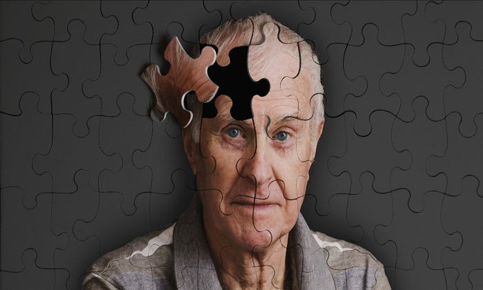 Alzheimer için korkutan uyarı: 2050’de Türkiye 4’üncü sırada!