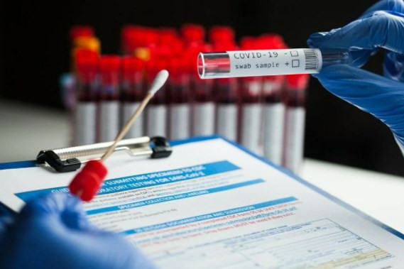 13 soruda PCR testi zorunluluğu