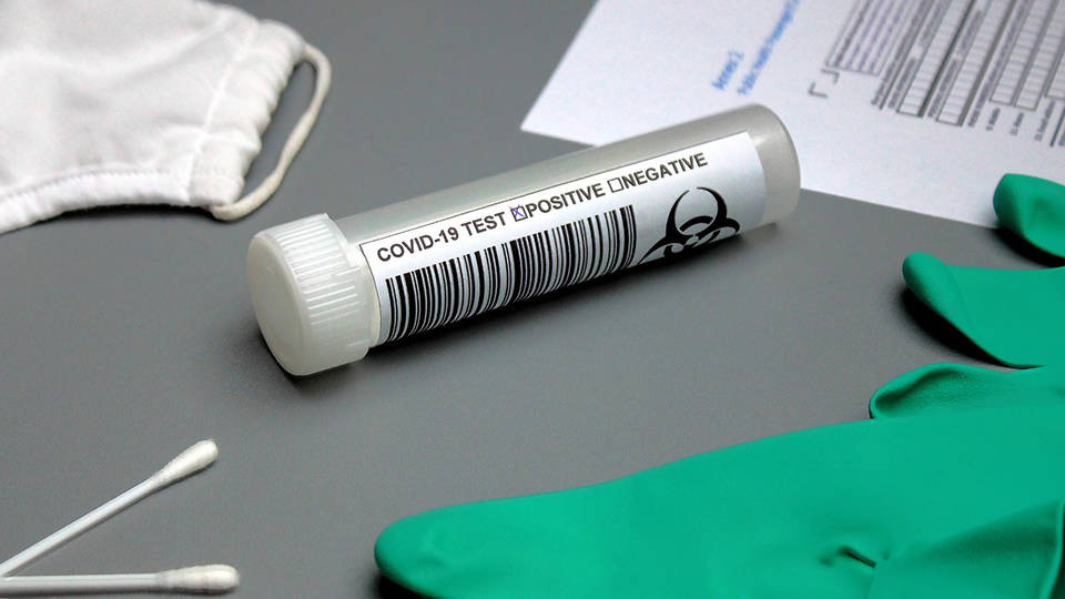 DSÖ'den yeni varyantlar için 'daha fazla test' çağrısı!