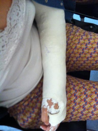 Başak Özçelik Twitter'dan dayak fotoğraflarını paylaştı